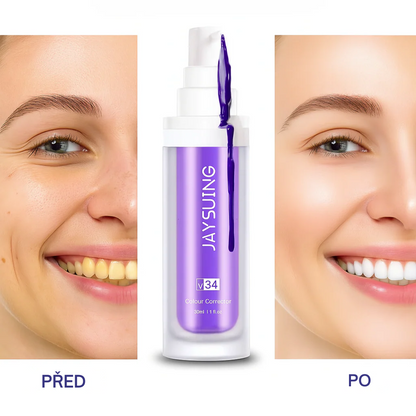 GlumiWhite™ – V34 Bělení – [AKCE POUZE DNES]